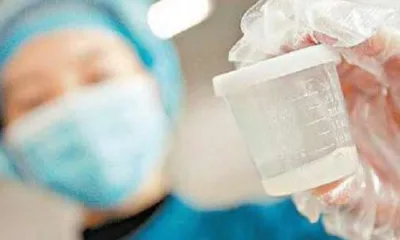 Virus Corona di Sperma