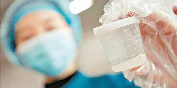 Virus Corona di Sperma