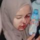Seorang wanita masaa pendukung, terluka di kepala. (ist)