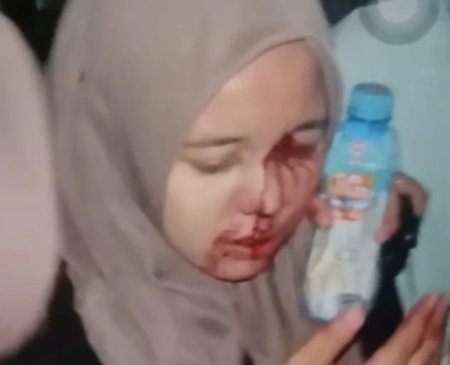 Seorang wanita masaa pendukung, terluka di kepala. (ist)
